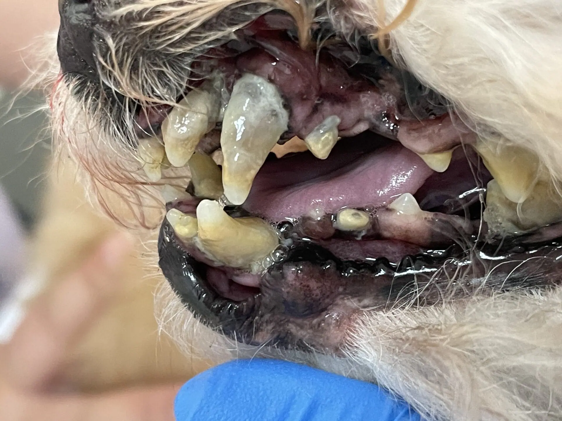 驚! 口腔裡的雪山隧道 : 口鼻瘻管 (Oral Nasal Fistula) 3 13849434 EB1A 4A17 8BE3 0BC3DB396CCC 2
