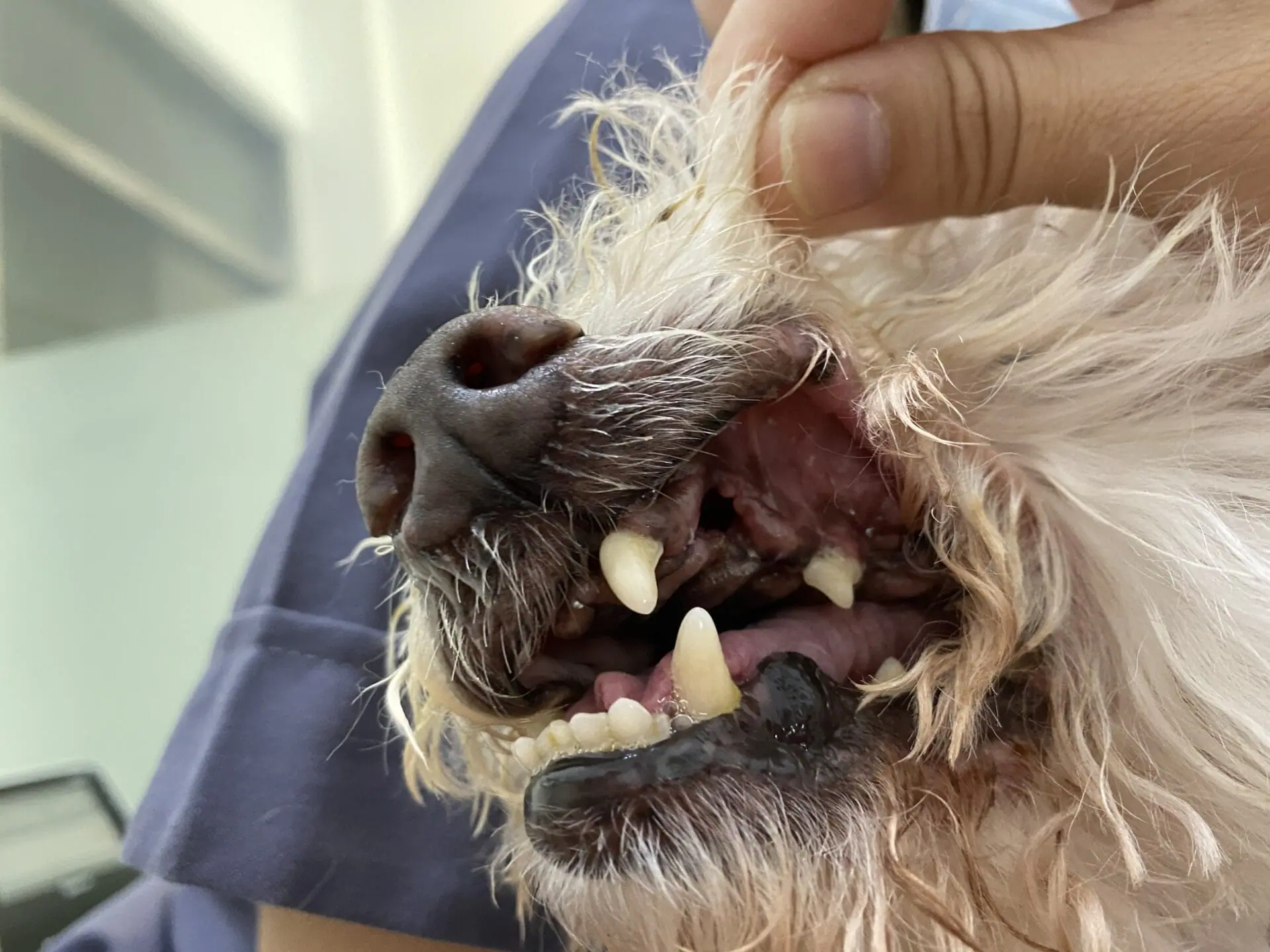 驚! 口腔裡的雪山隧道 : 口鼻瘻管 (Oral Nasal Fistula) 2 B92E6B91 C920 4798 940D 2B8BDDFA7072 1