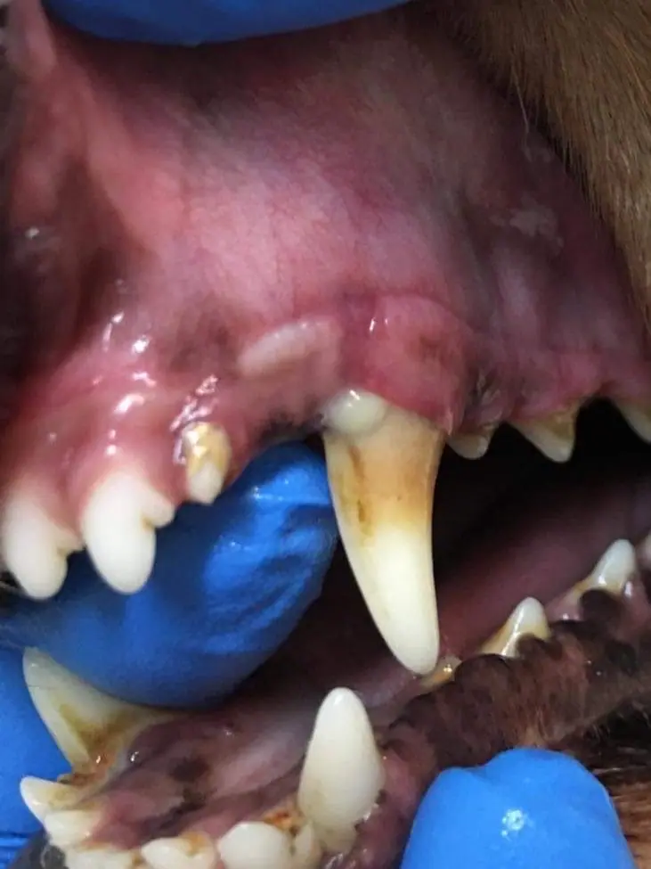 驚! 口腔裡的雪山隧道 : 口鼻瘻管 (Oral Nasal Fistula) 4 C7BCCF53 08F4 413E A10D 23888362980E edited