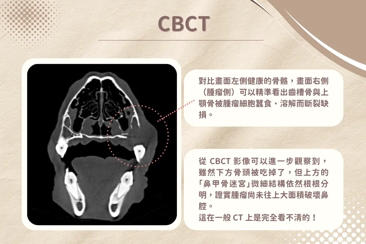 寵物CT與CBCT有何不同?從口腔腫瘤案例,看懂獸醫牙科3D影像的差異 3 dog underbite 1 2 2