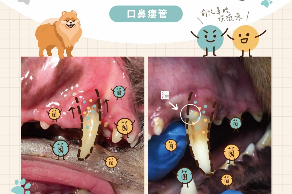 口鼻瘻管就像牙周病的隧道，將細菌由牙周病的發源地帶往鼻腔，進而導致更嚴重的感染。