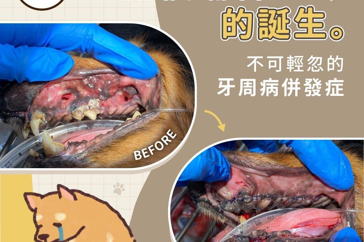 兩個廔管的誕生