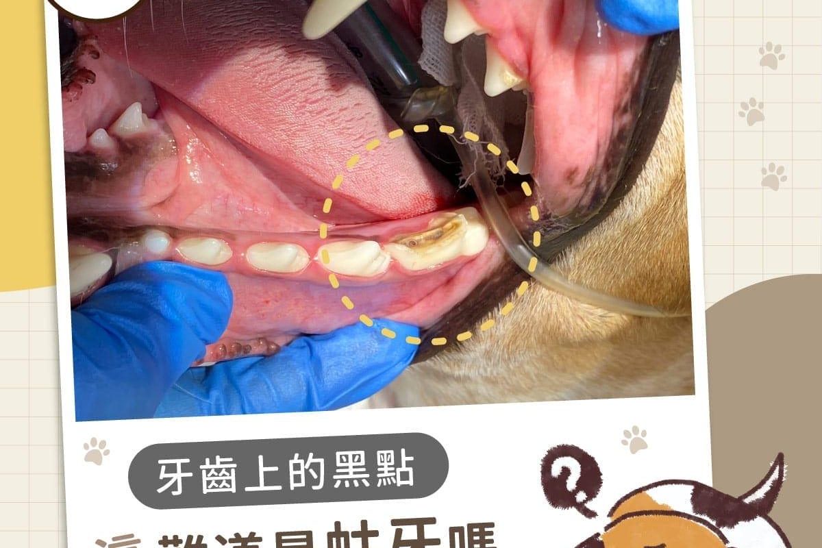 牙齒上的黑點